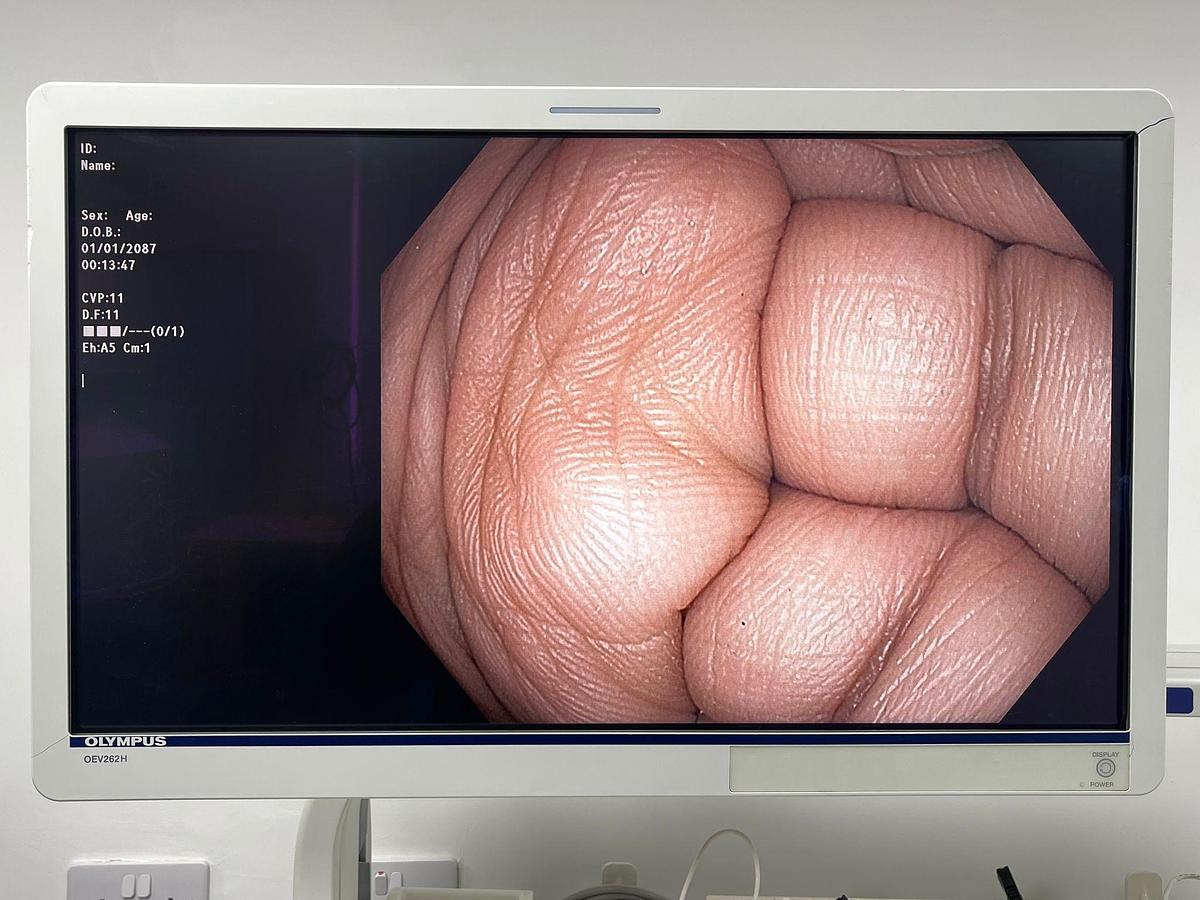 Used Olympus Scope Model: CF-HQ190L