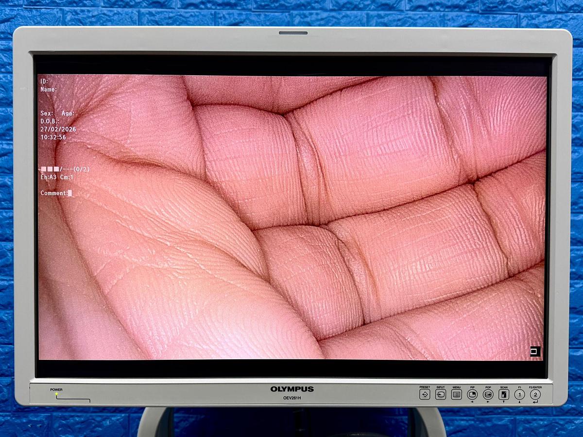 Used Olympus OTV-S190 Tower Processor OTV-S190  SN: 7354579 Light Source CLV-S190 SN: 7304202 Olympus OEV261H Monitor  YOM: 2013 SN: 7354100 Olympus UHI-4  YOM: 2021 SN: 7159219 Olympus IMH-20 SN: 7331770 Olympus Camera Head CH-S190-XZ-E SN: 7506197 Olympus MAJ-1921 Keyboard  Sony Digital Colour Printer