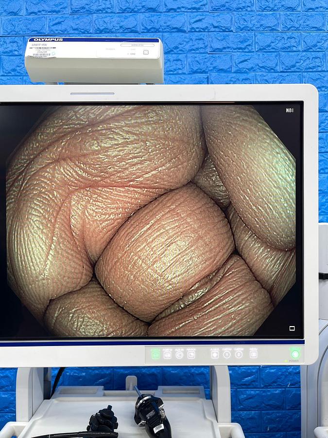 Used Olympus CV-190 with CLV-190 Endoscopy Tower 