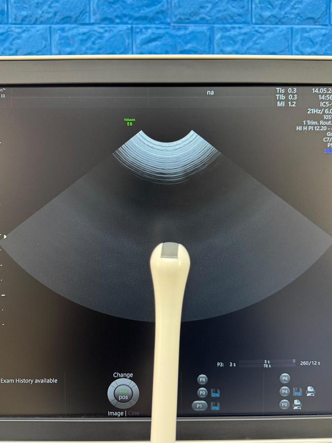 Used GE Voluson E8 Ultrasound YOM: 2019  Probes  - C1-6-D YOM: 2019 - C2-9-D YOM: 2014 - IC5-9-D 
