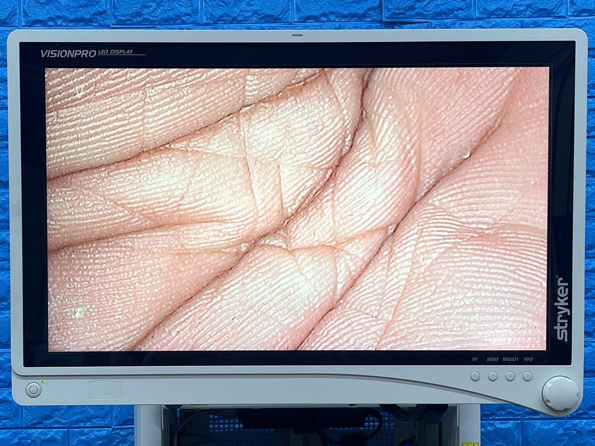 Used Stryker 1588 Tower, LCD Monitor, YOM: 2017