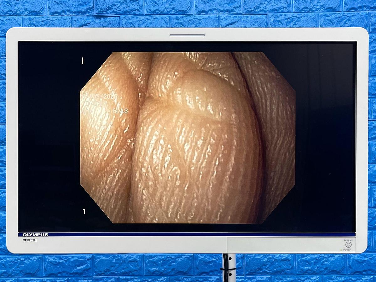 Used Olympus Scope Model: GIF-H180J