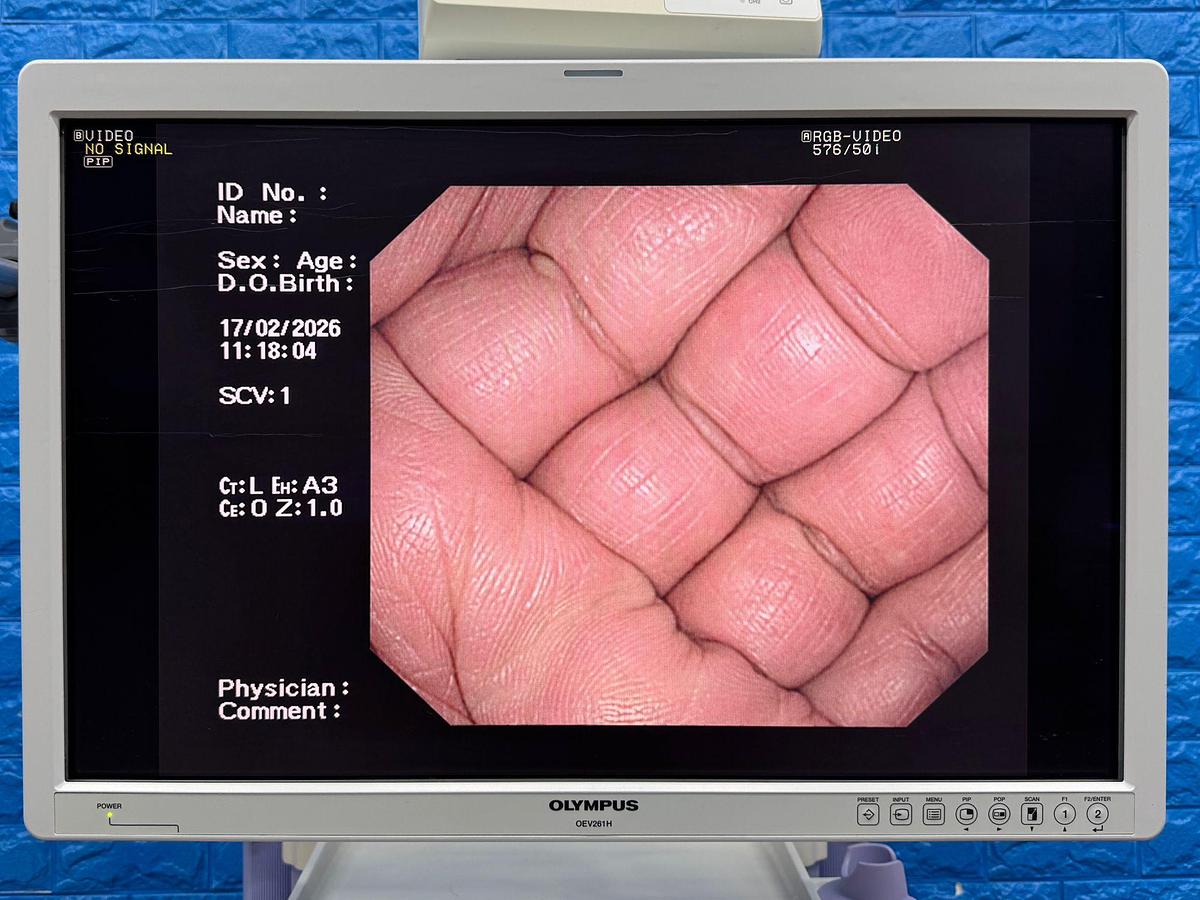 Used Olympus tower  Model : CV-260SL Scope Model : CF-H260DL HD colonoscope  Scope Model : GIF- H260 HD gastroscope  