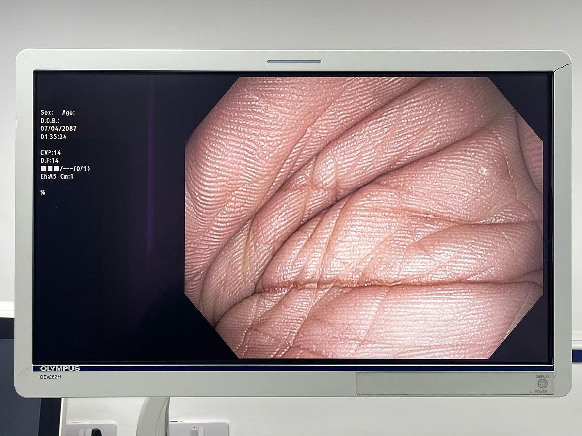 Used Olympus Scope Model: PCF-H180AL