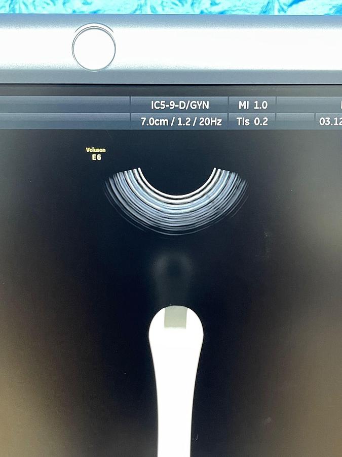 Used GE Datex Ohmeda Voluson E6 Ultrasound YOM: 2015 Probes RAB6-D YOM: 2015 IC5-9-D YOM: 2015
