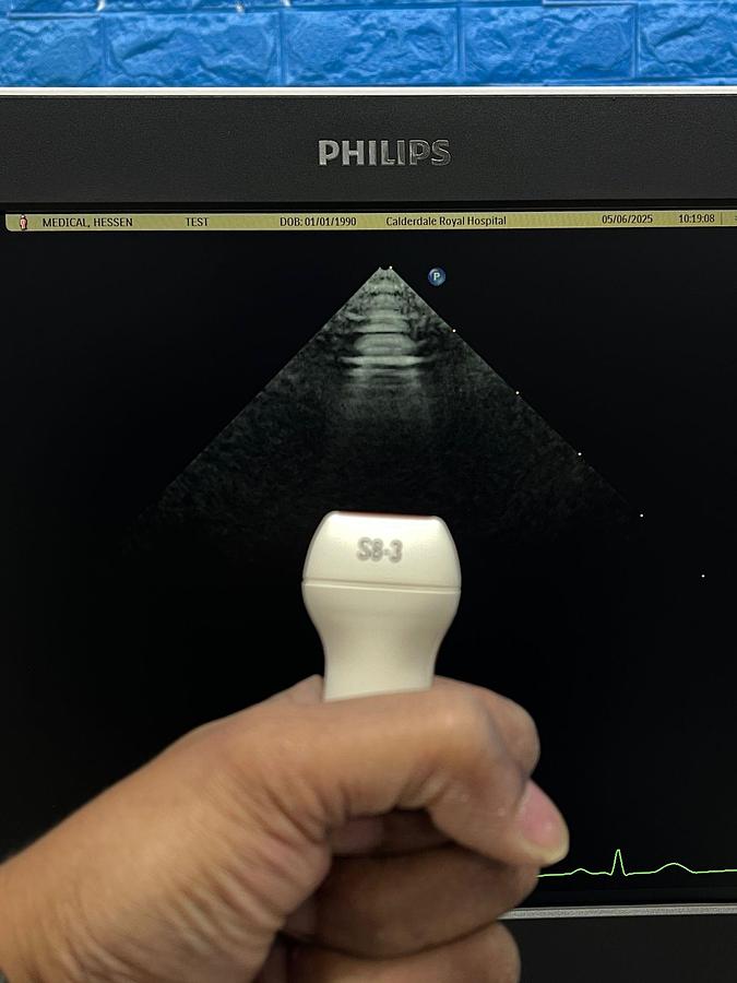 Used PHILIPS EPIQ 7C Ultrasound SW: HW B.0 YOM: 2018 Cardiac – Vascular Ultrasound