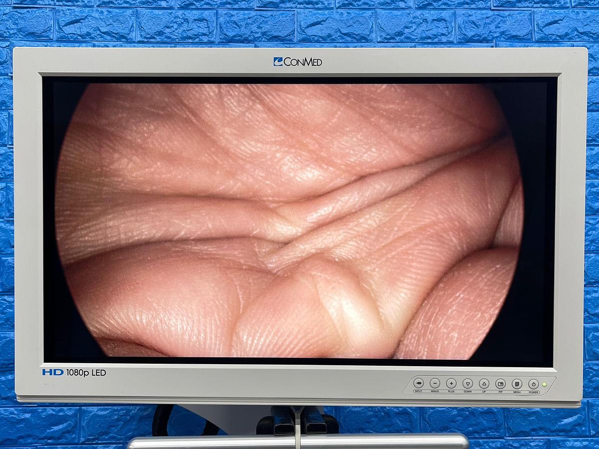 Used ConMed  Laparoscopy Tower