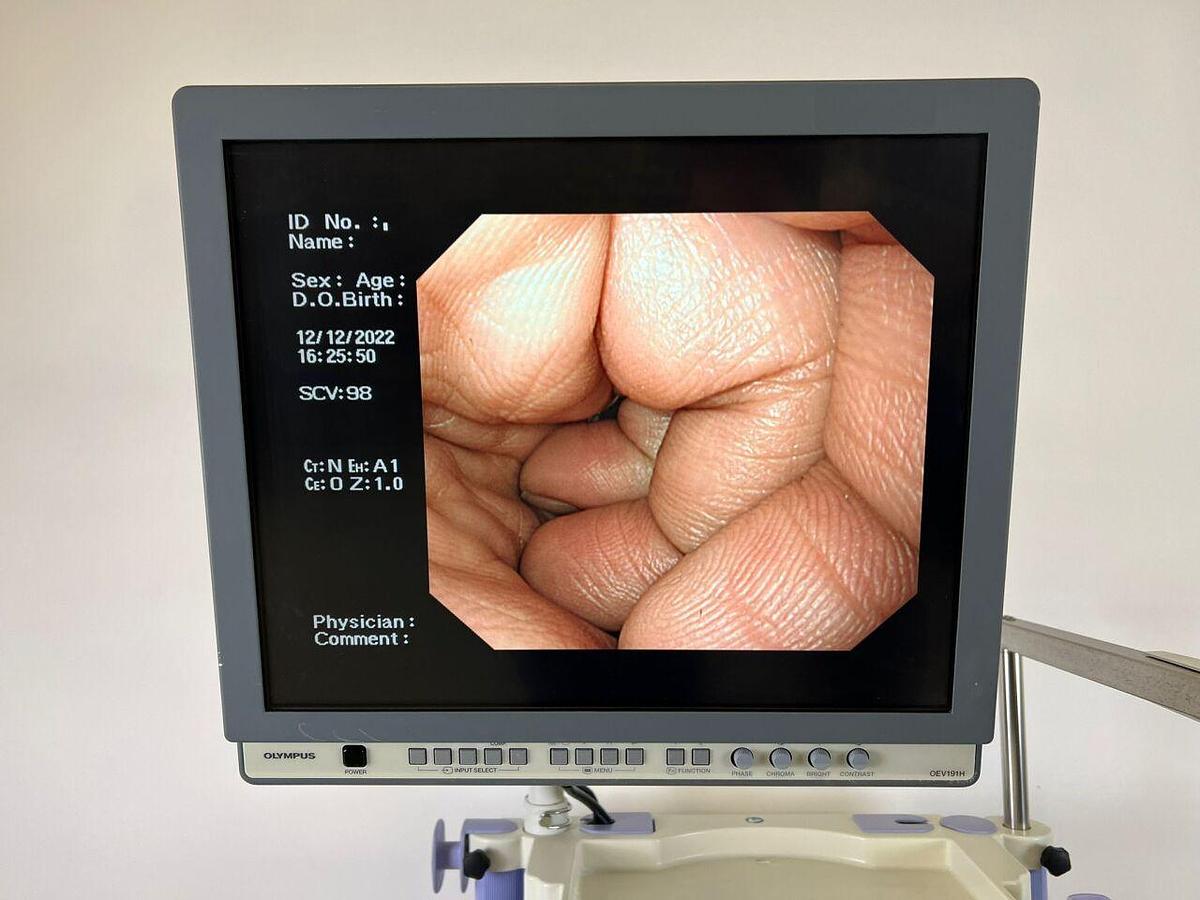 Used OLYMPUS CV-260SL complete Tower with GIF-H260 Gastro and CF-Q260DL Long Colonoscope Endoscope