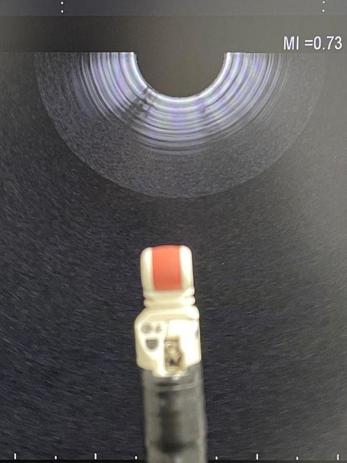 Used OLYMPUS EU-ME1 - Power Input Voltage: 110 Endoscopy Ultrasound Processor