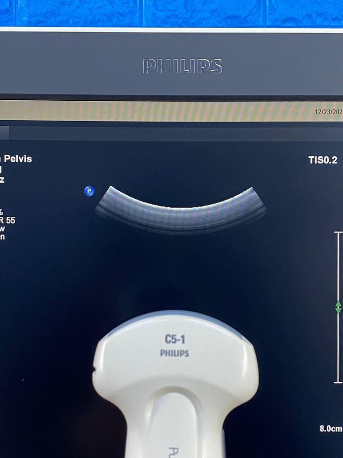 Used Philips Affiniti 70G PureWave Software Version: 9.0.16 Hardware B.0 YOM: 2018 Probes L15-7io C10-3v C9-2 C5-1