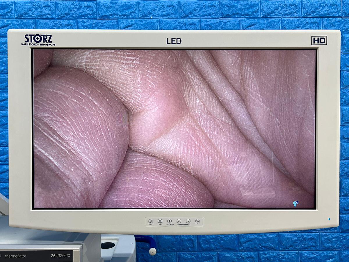 Used KARL STORZ Spies Tower Laparoscope