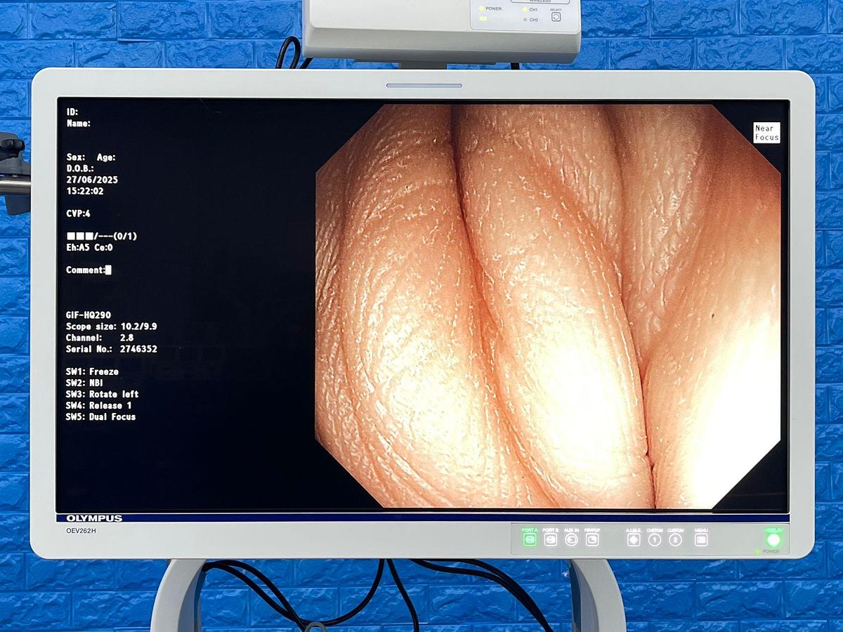 Used Olympus GIF-HQ290 Gastroscope