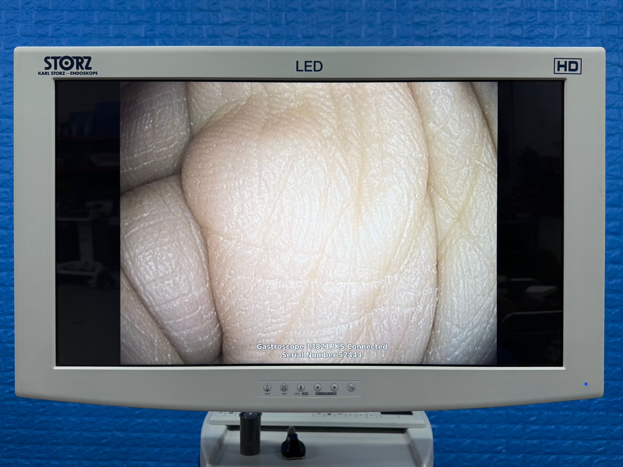 Used Karl Storz Scope  Model: 13821 PKS SN: 52444