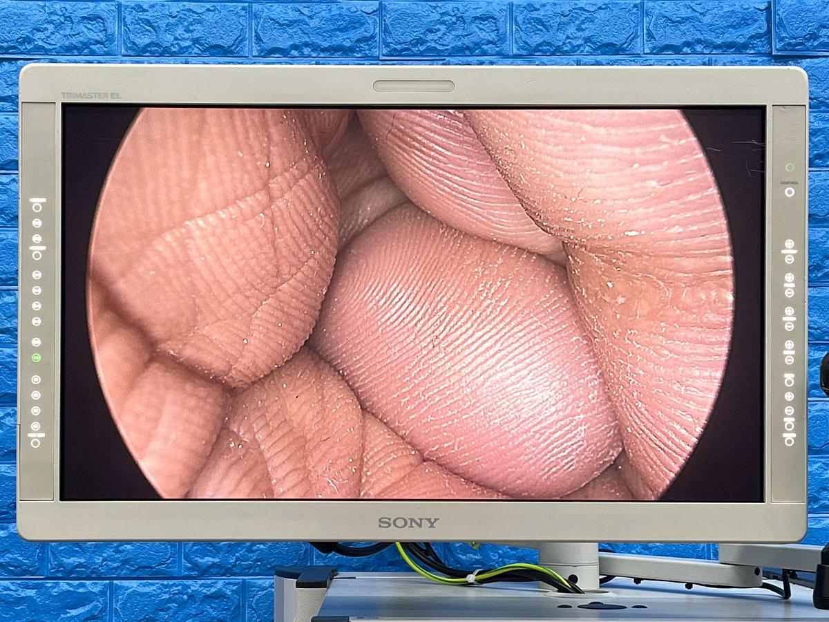 Used Arthrex Synergy HD3 Tower