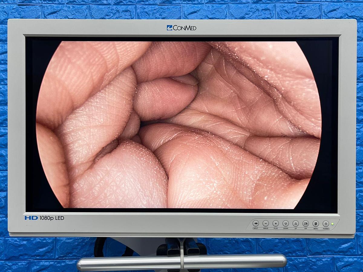 Used ConMed  Laparoscopy Tower