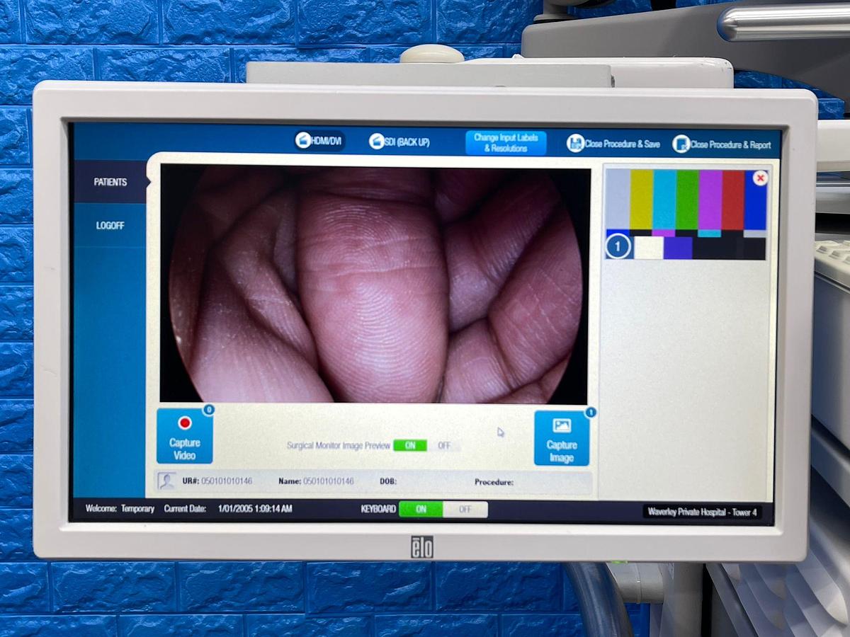 Used ConMed  Laparoscopy Tower