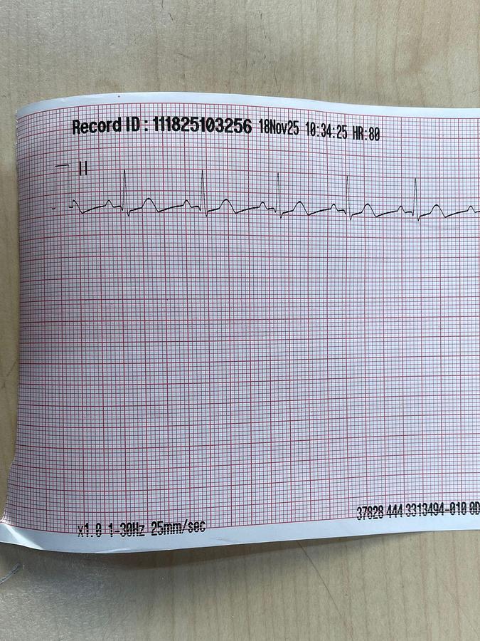 Used Physio Control Lifepak 15 Monitor YOM: 2018