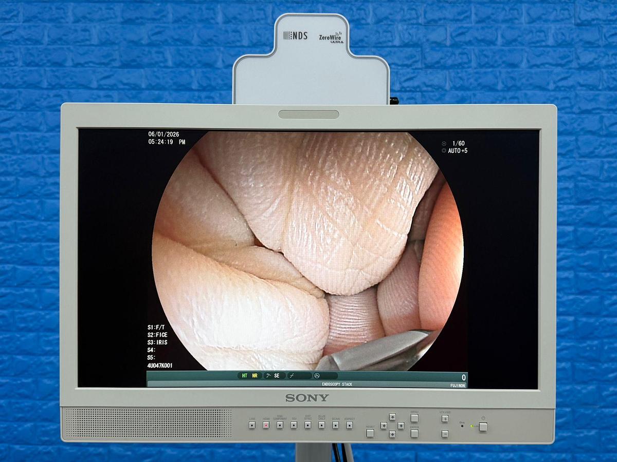 Used Fujinon Scope EG-580 UT Linear Ultrasonic Endoscope YOM: 2018 