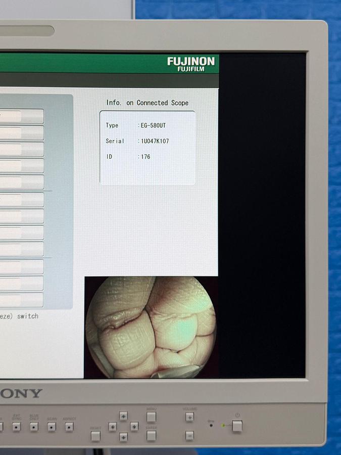 Used Fujinon Scope EG-580 UT Linear Ultrasonic Endoscope 