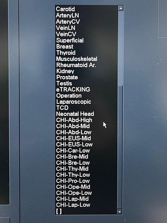 Used Hitachi Aloka Arietta V70 Ultrasound  YOM: 2016 With 5x Probes