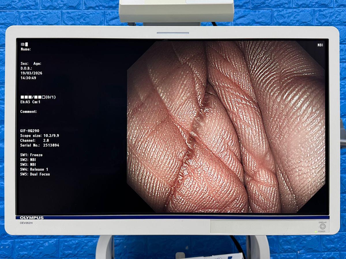 Used Olympus Scope  Model: GIF-HQ290 