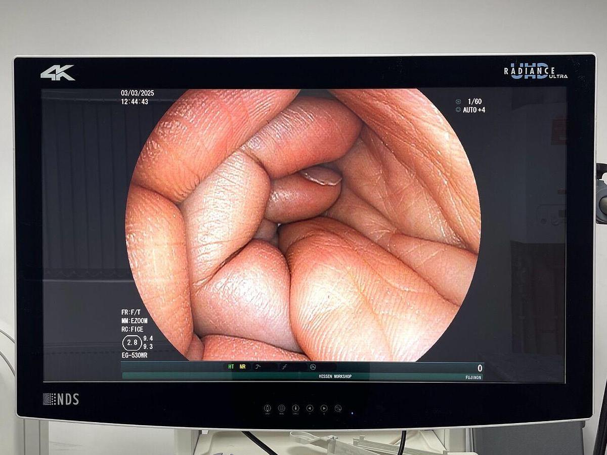 Used FUJINON Scope Model