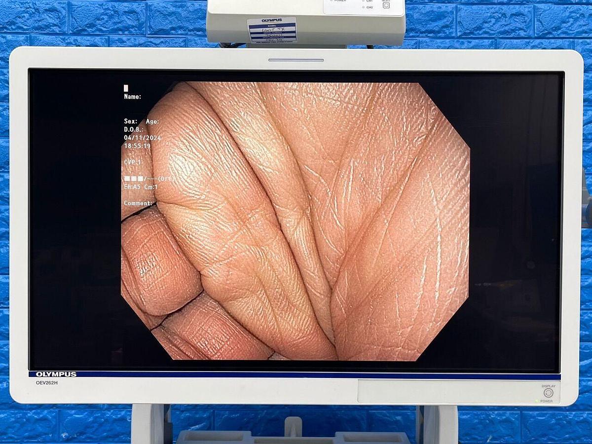 Used OLYMPUS CV-190/CLV-190 Tower Endoscope