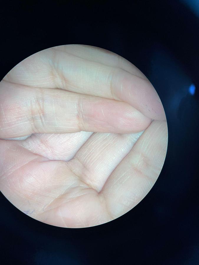 Used Carl Zeiss OPMI Neuro NC 4