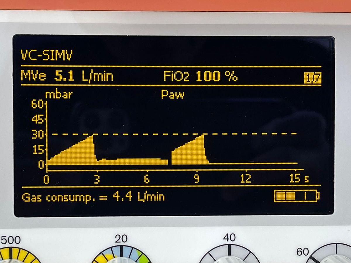 Used Dräger Oxylog 3000 Plus YOM: 2015