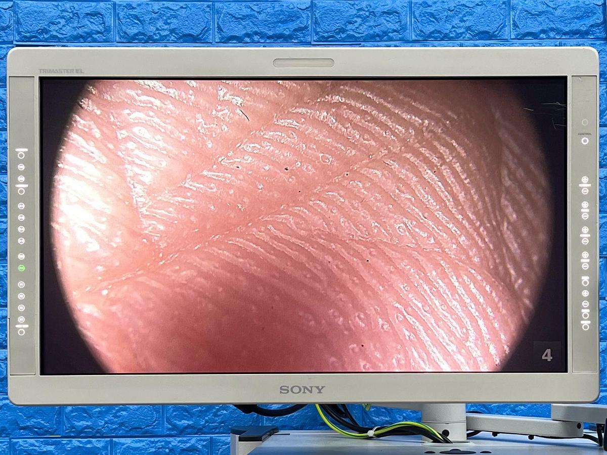 Used Arthrex Synergy HD3 Tower