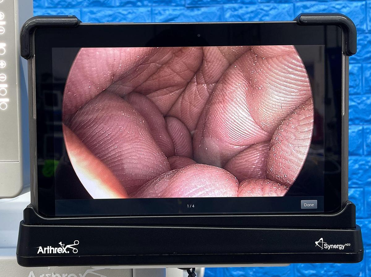 Used Arthrex Synergy HD3 Tower