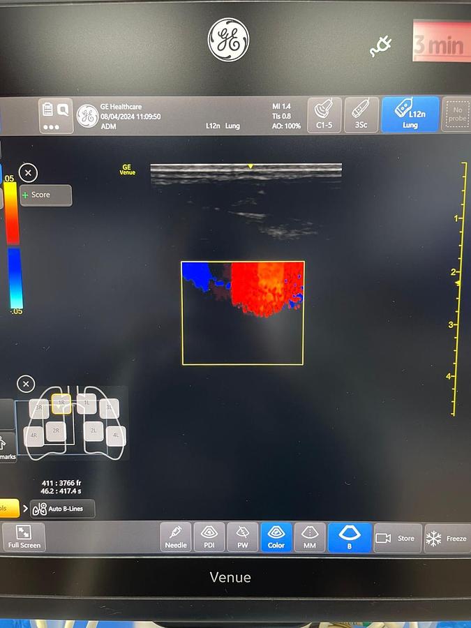 Used GE Venue YOM: 2018 With 3 Probes.