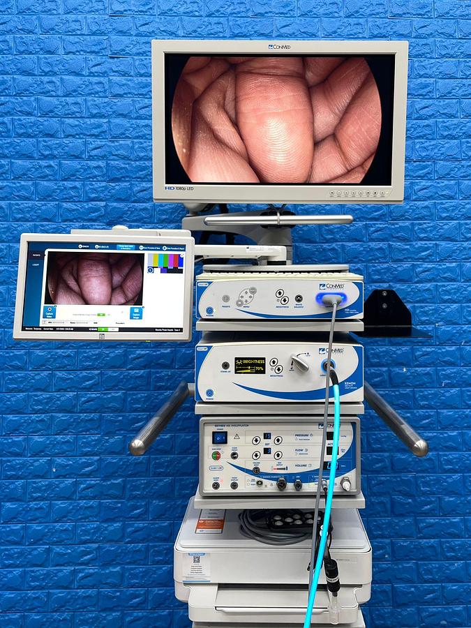 Used ConMed  Laparoscopy Tower