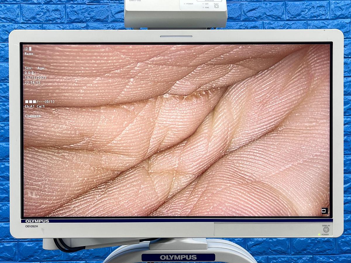 Used Olympus Camera Head Model: CH-S190-XZ-E 