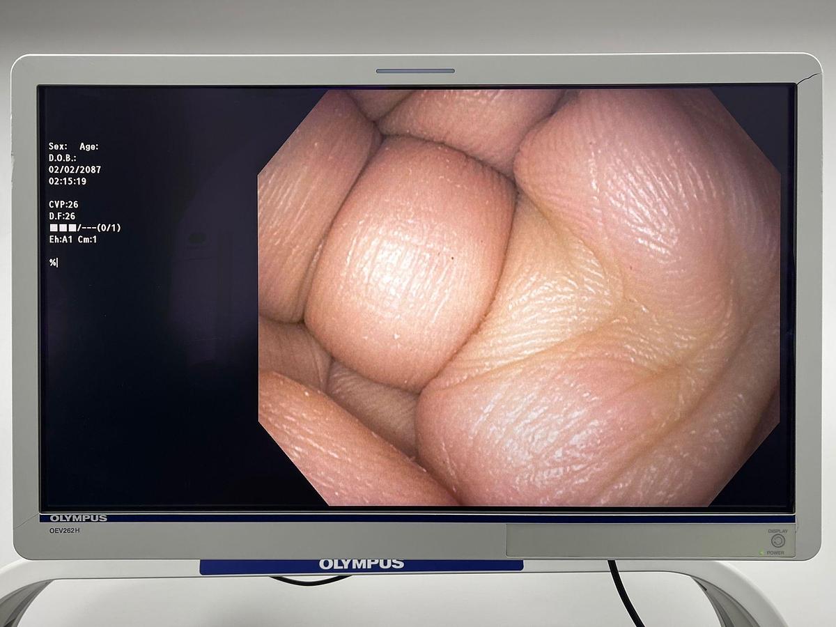 Used Olympus Scope Model: GIF-H190N