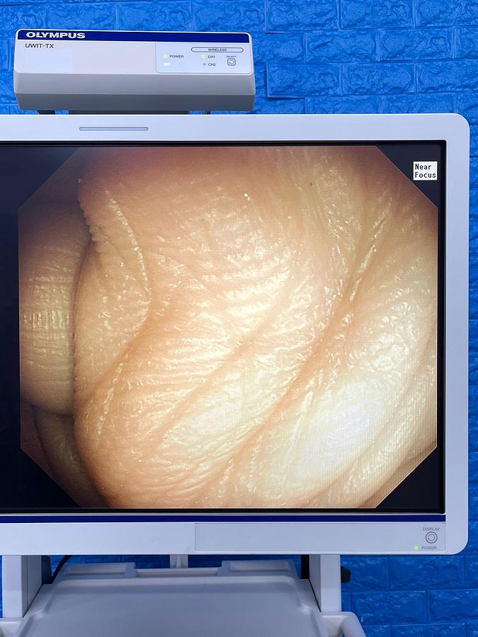 Used Olympus scope Model: GIF-HQ290