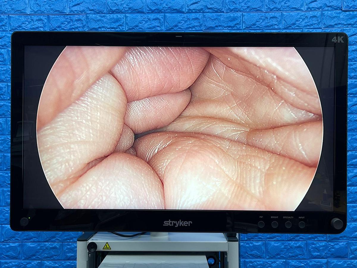 Used Stryker 1588 Laparoscopy Tower - Stryker 1588 Laparoscopy Tower  - Stryker Led Monitor 32 inch 4K YOM: 2016 - Pneumo Care - Synk Wireless Transmitter  - 1588 HD Camera Head  - SDC3 HD Information Management YOM: 2013 - 1588 HD Image Processor YOM: 2016 - LIO LED Light Source YOM: 2016 - SDP 1000 Digital Colour Printer