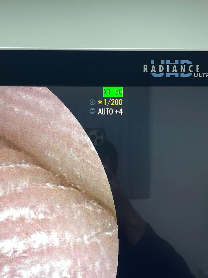 Used FUJINON Scope Model: EC-600WM Colonoscope Colonoscope