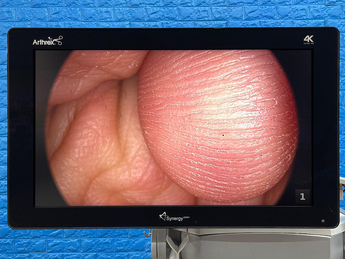 Used ARTHREX Synergy UHD4 4K Tower LED 4K Monitor 32 inch YOM: 2018