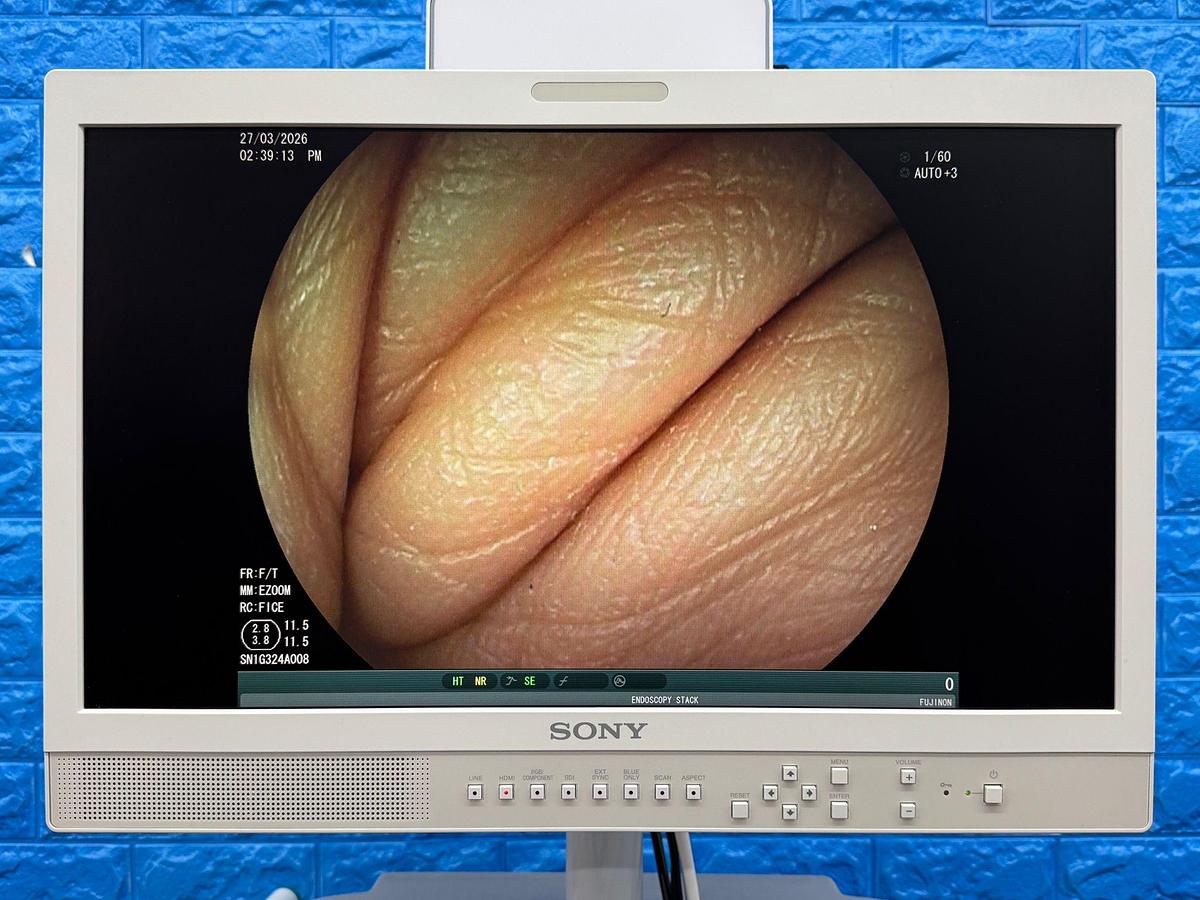 Used Fujinon Scope  Model: EG-530D 