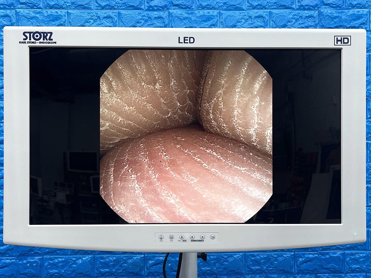 Used Karl Storz Scope Model: 11272 VH