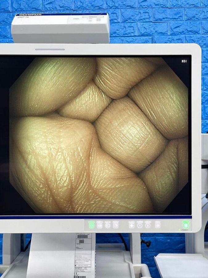 Used OLYMPUS CV-290 CLV-290 Complete Towers with 290 HD Gastro and 290 HD Long colonoscope Endoscopy Processor