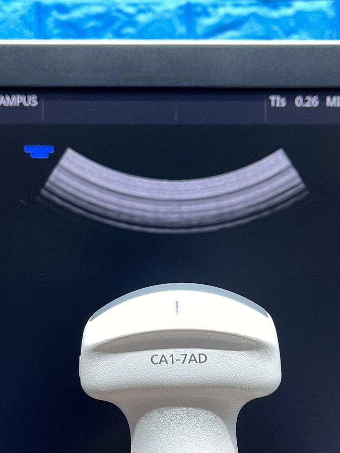 Used Samsung HS 60 Ultrasound  YOM: 2018 