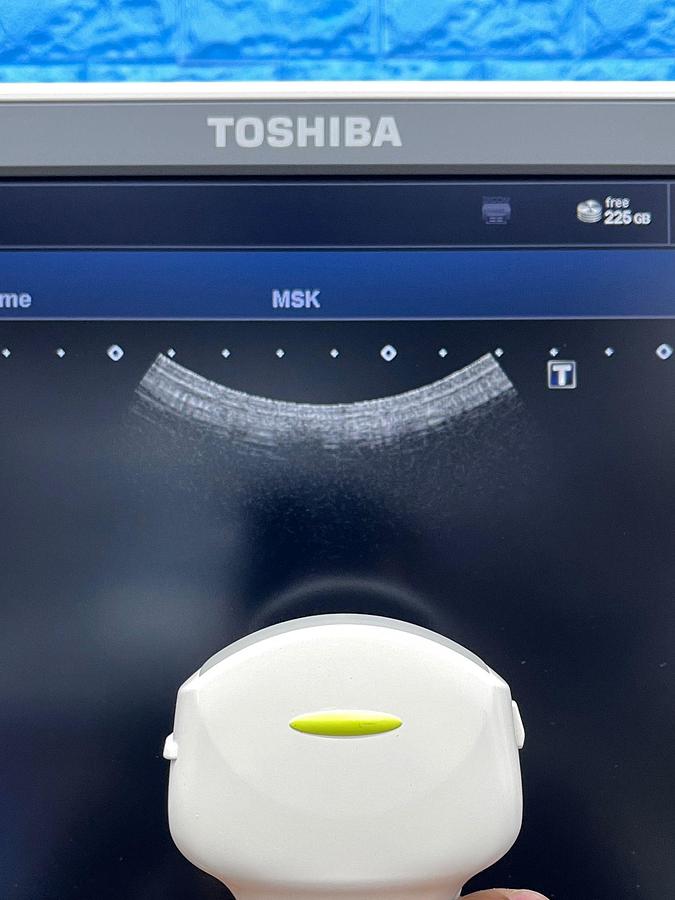 Used -Toshiba Ultrasound Aplio 500 YOM: 2015