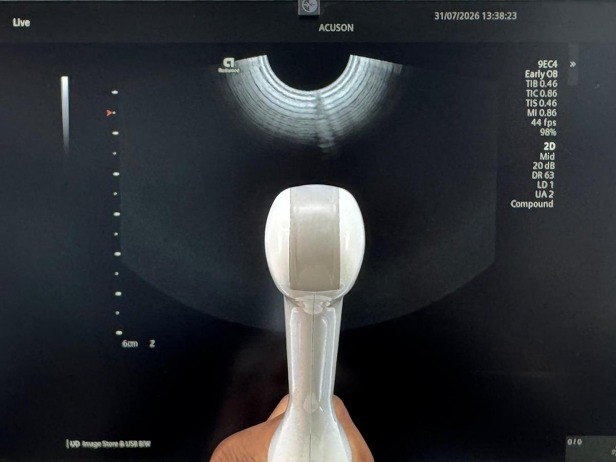 Used Siemens Acuson Redwood Diagnostic Ultrasound REF: 11503314 YOM: 2022 Probes 9C3 YOM: 2025 7VC2 YOM: 2021 9EC4 YOM: 2022