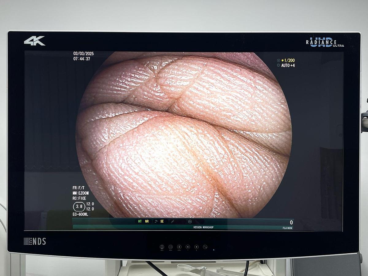 Used FUJINON Scope Model: EC-600WL