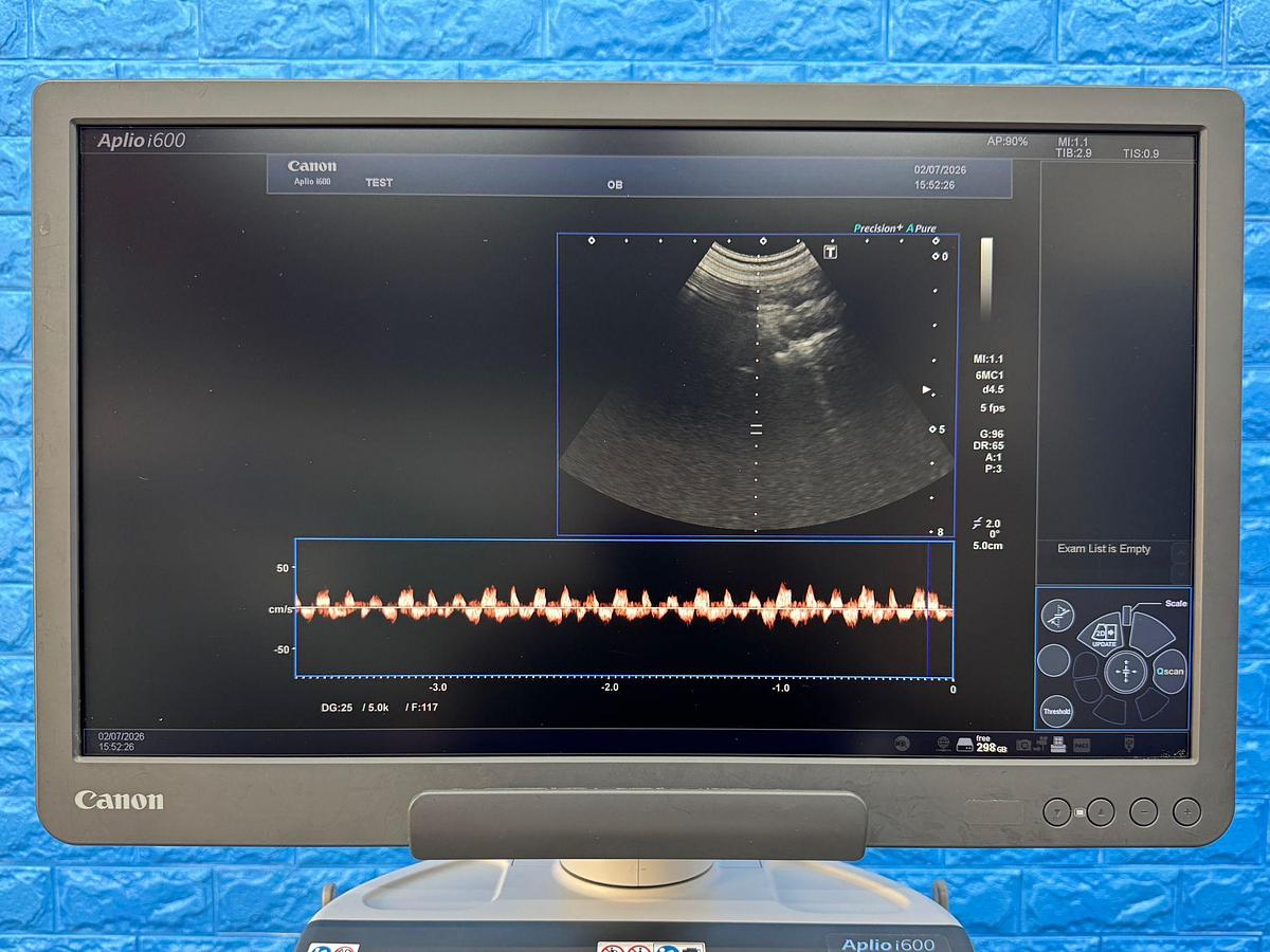 Used TOSHIBA Convex Array Transducer Probe Model: PVT-382BT YOM: 2012