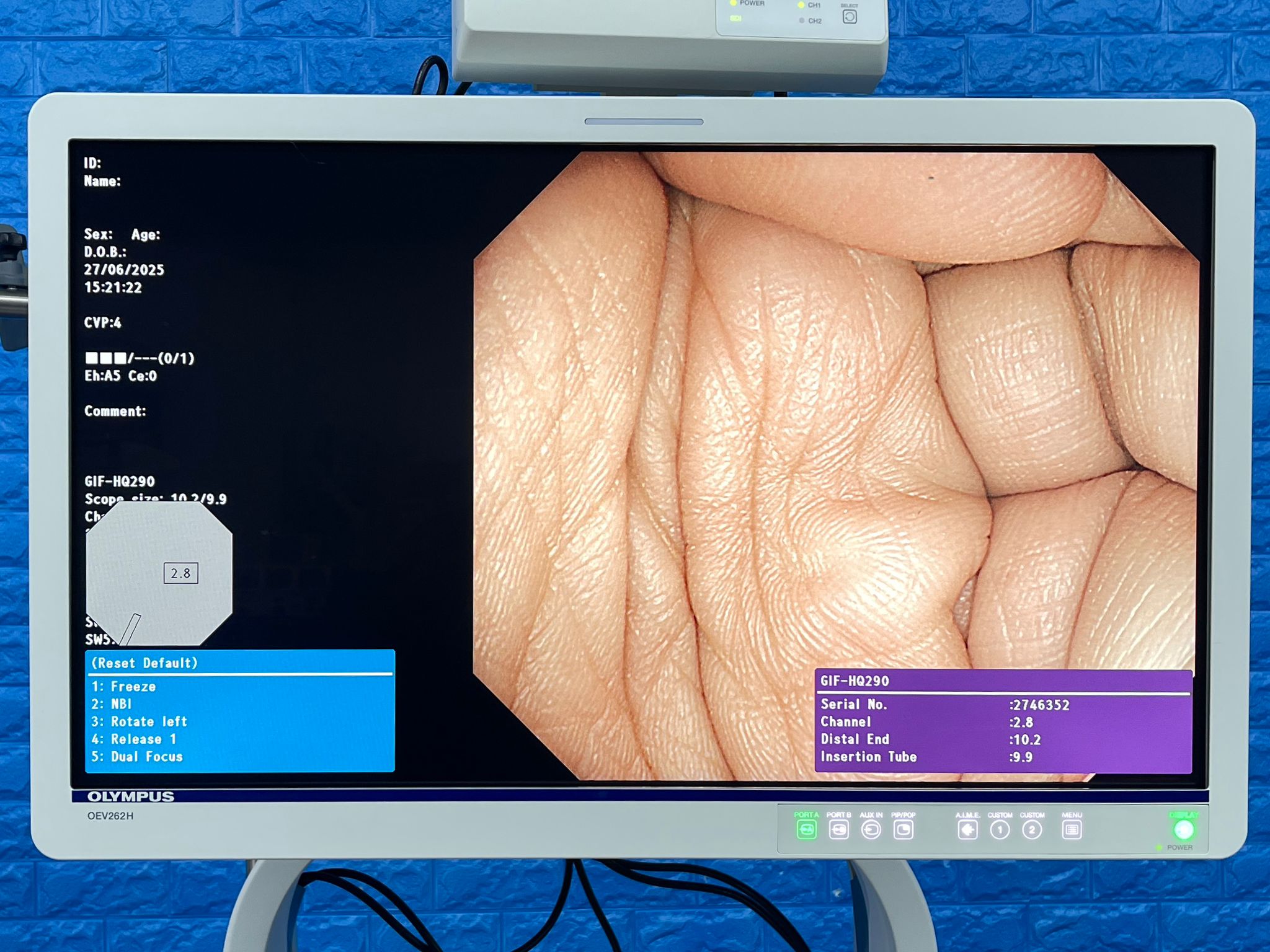 Used Olympus GIF-HQ290 Gastroscope