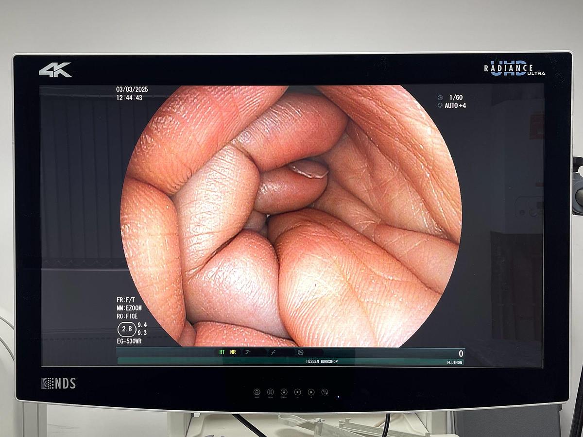 Used FUJINON Scope Model: EG-530WR