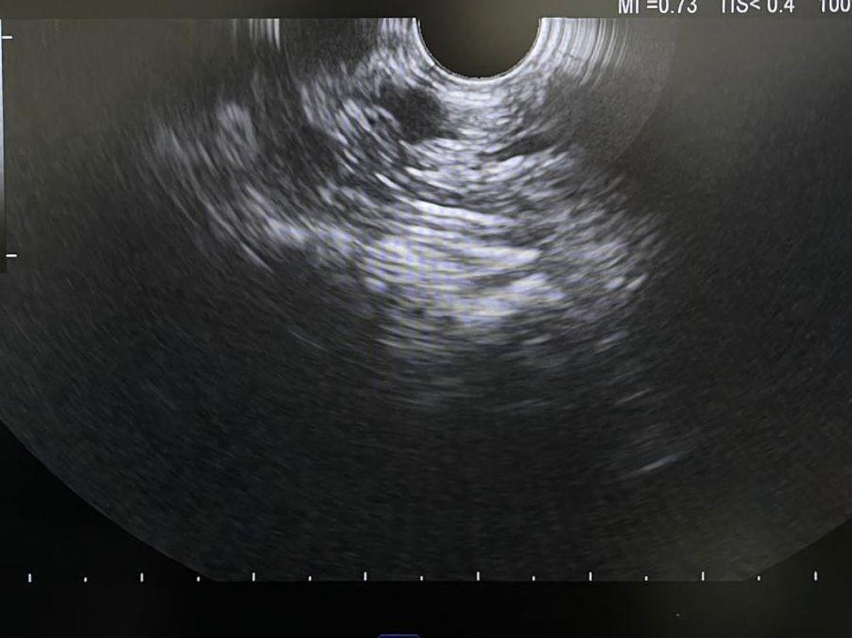 Used OLYMPUS EU-ME1 - Power Input Voltage: 110 Endoscopy Ultrasound Processor